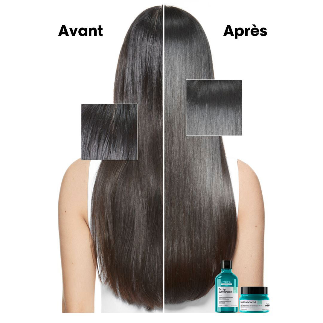 Avant/après utilisation de la gamme Scalp Advanced